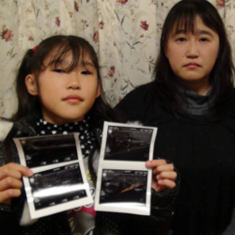Japanisches Mädchen mit den Bildern seiner Schilddrüsenuntersuchungen, Foto: Ian Thomas Ash