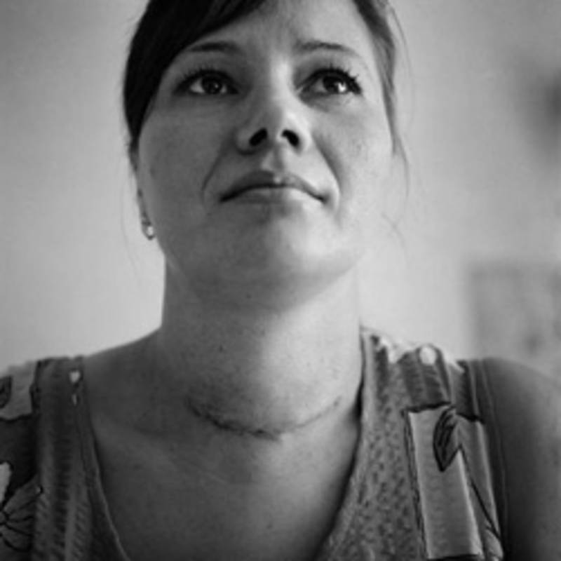 Galina Miroschnitschenko, Kiew,  hat Schilddrüsenkrebs. Foto: Robert Knoth